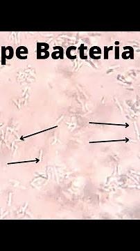 Rod shape Bacteria in urine | Motile and non motile | ‪@medicallabtechnologysajal6903‬