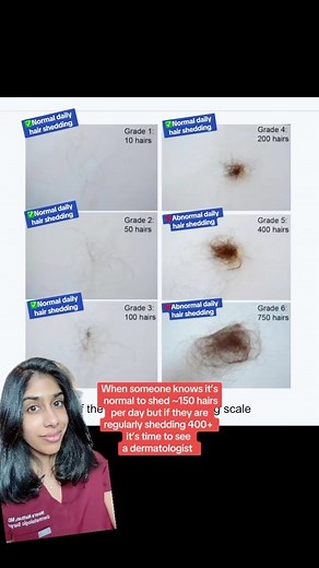 56K views · 22 reactions | “Hair shedding or hair fall is normal...