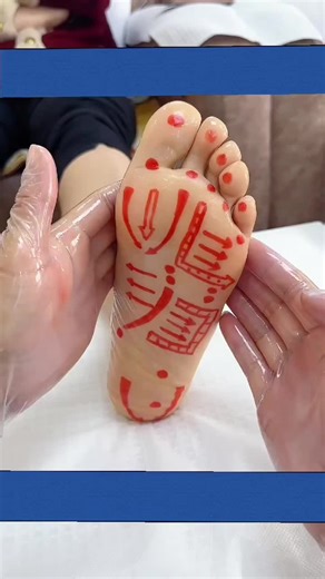 Understanding Calcaneal Spur and Heel Pain