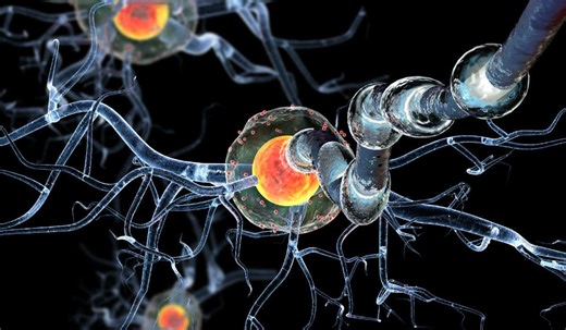 Esclerose múltipla: sintomas, diagnóstico, tratamento e tem cura?