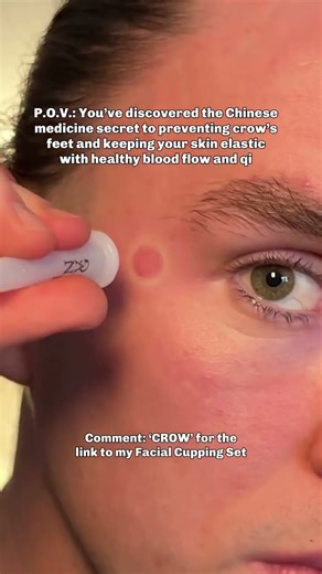 The TCM Wrinkle hack 👇🏼 Grab your facial cups and apply light suction to the outer corners of