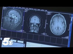 Experts explain what to do during a epileptic seizures