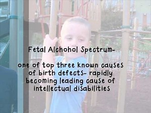 Teaching Intellectual Disabilties