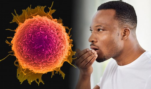 Mouth cancer: What are the causes and symptoms?