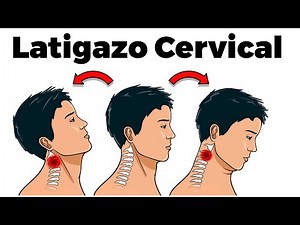 LATIGAZO CERVICAL: causas, síntomas y tratamiento