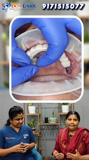 Best laser Dental clinic and Implant Centre on Instagram: "பல்லு இருந்தும் இல்லாதது மாறி இருந்தது ! Youtube பார்த்து தான் நான் இங்க வந்தேன் ! Our address : Best Laser Dental Clinic And Implant Centre Plot no.160&161 Ramanujam salai, Antony St, Sridevi karumari amman nagar, Valasaravakkam, Chennai, Tamil Nadu 600087 Phone No : landline : 044 43856017, mobile ( wats app ) +91 9171515077 Email : bestdentalno1@gmail.com website : www.drmurugavel.in For more details / Appointments contact : 917151507