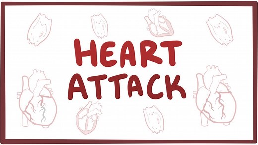 Myocardial infarction: Video, Causes, & Meaning | Osmosis