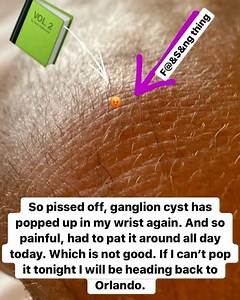 15K views · 123 reactions | Does smashing a ganglion cyst really work ??? It popped up yesterday and only played 9 holes in the proam. So painful and on the nerve. I’m going to try and burst it by smashing it with a book... hope it works or I’m heading home tomorrow to Orlando to have it Syringed. 爛 | Ian James Poulter | Facebook