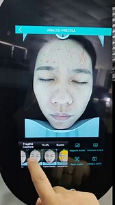 Skin Diagnosis System Skin Analysis Machine Facial Care Magic Mirror Max Face Detector Skin Analyzer Scanner Skin Care Tools(3-6 Days Delivery)