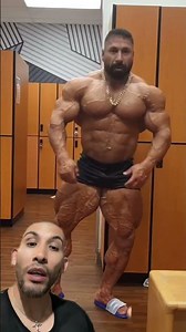 genética o ruptura de tendón del bíceps #shortsvideo #shortsviral #motivacion