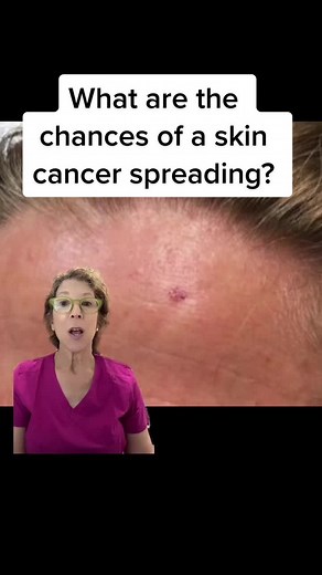 Understanding Skin Cancer Types and Early Detection