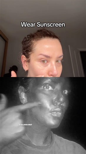 Sunscreen UV Camera Check
