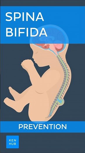 Spina bifida: Prevention | Kenhub #spinabifida