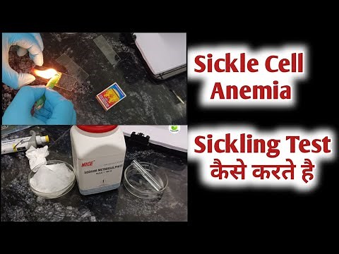 sickle cell test procedure I Sickling test