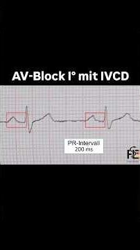 #AV_Block_IVCD#EKG#Fachsprachprüfung#Kenntnisprüfung#Medizinstudium