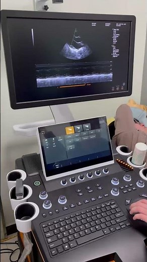 LifePlus UltraScan LPM-810 | Easy BM Mode Operation (Color Doppler Ultrasound Demo)