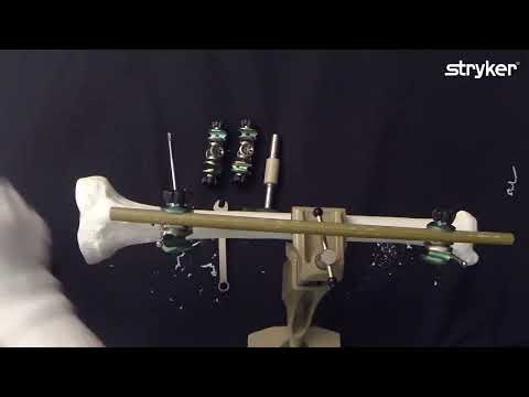Hoffmann 3 External Fixation System: How to build a Tibia Single Rod frame.