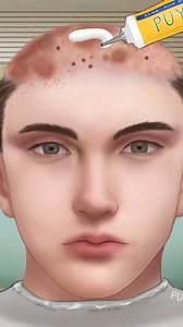 Treatment and removal of lice and scabies scalp from the boy #transformation #asmr #asmrsounds #skincare #skincareroutine #beauty #satisfying #acne #extrusion #lashes #deepclean #viralreels | Nikolas Bushi