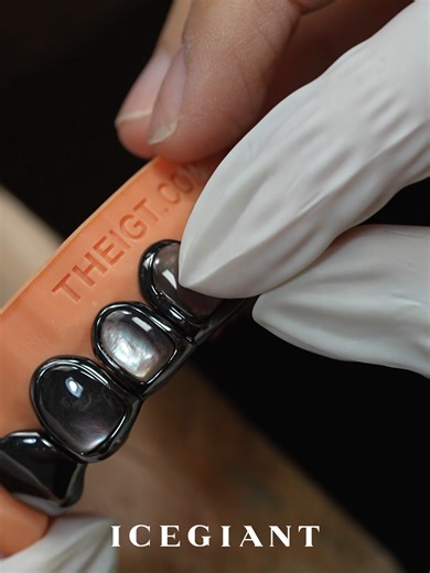 Custom Grillz: Discover Your Unique Shine