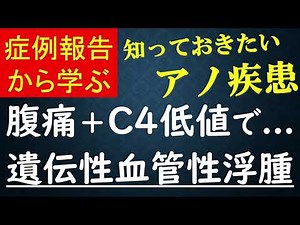 症例報告から学ぶ 腹痛＋C4低値で... 遺伝性血管性浮腫 知っておきたいアノ疾患