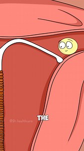 How Does the Copper IUD Actually Work? 🩺 | Darren Healthcare