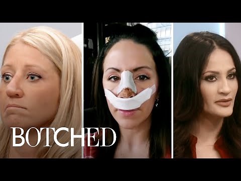5 Most Heartbreaking Nose Jobs | Botched | E!