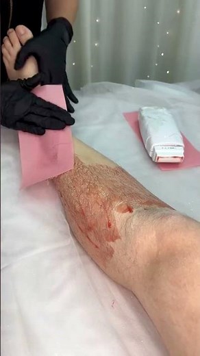 Quick Waxing Hair Removal⚡