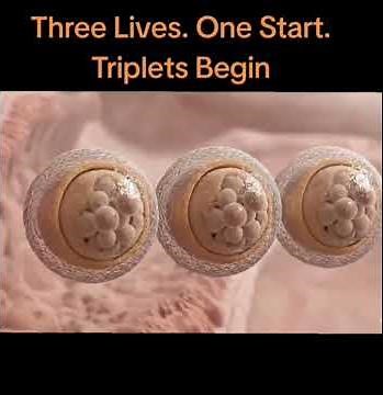 TRIPLETS: How triplets are formed in the womb