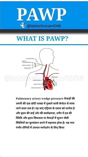 PAWP|PAEP full form|Pulmonary Artery Wedge Pressure|Anatomy#new#sceince#study#neet#motivation#shorts