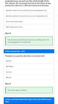 Central Nervous System CNS: Brain – Structure, Divisions Forebrain, Midbrain, Hindbrain, and Fu...