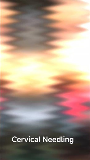 Cervical Needling @skillphysioacademy @physionews4319 @FITNESS-PHYSIO-WORLD