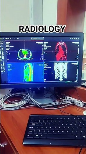 radiology technologist #ct technician #motivation #doctor