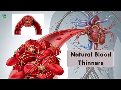 How to Thin Your Blood Naturally and Prevent Blood Clots | Home Remedies