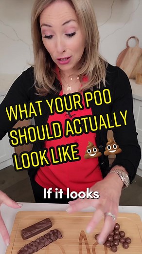 What Your Poo Should ACTUALLY Look Like Dr. Janine provides important insights into what a healthy stool should look like. A healthy stool should have the shape and consistency of a Mars bar, while stools that resemble an O Henry bar may indicate that they have been sitting in the intestine for too long. If you notice bits of undigested food in your stool that resemble M&Ms, it could be indicative of leaky gut syndrome. On the other hand, if your stool is hard and short like a Bounty bar or in t