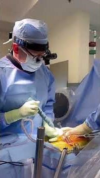 Watch Us Perform An L5-S1 Disc Replacement- Dr. Rovner