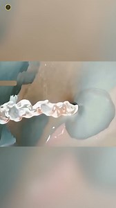 69K views · 619 reactions | Prostate in female | Crazy Factor English | Facebook