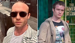 Ex-Corrie star Chris Fountain left 'speaking like a toddler' after suffering stroke