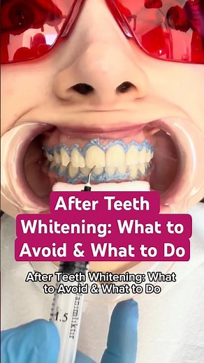 After Teeth Whitening: What to Avoid & What to Do #dentalcare #dentist #healthysmile #beauty