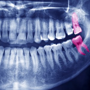 698K views · 5.2K reactions | Two dentists, Dr. Aaleeyah Pringle Alim and Dr. Amin Elsaeed, debunk 13 of the most common myths about teeth. | Insider Science | Facebook