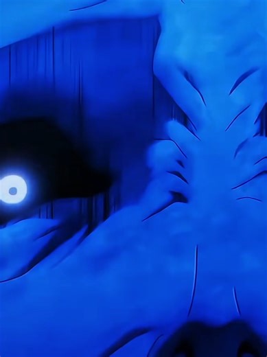 Understanding Pulpotomy in Dental Care