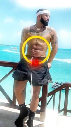 Drake Talks About SURGERY RUMOURS 😳🩻