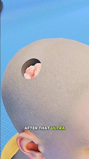 Neuralink Brain Chip Explained in 3D | Control Things With Your Mind 😳 Elon Musk Tech
