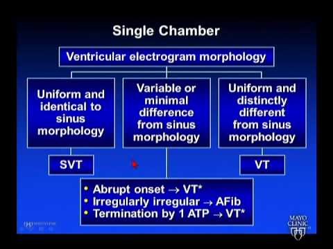 ICD Troubleshooting - Dr. Friedman, Mayo Clinic