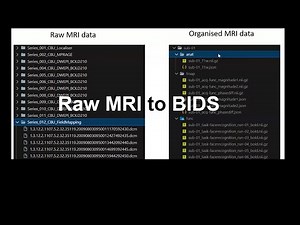 Organising your neuroimaging data. Part 1: MRI