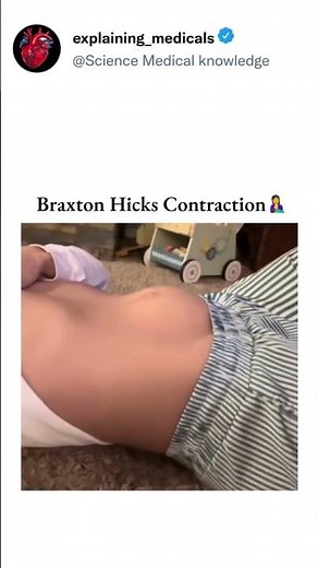 Braxton Hicks Contractions: Your Body’s “Practice Labor” 🤰
