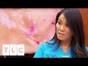 Woman With Mysterious Skin Condition Refuses To Believe Diagnosis | Dr. Pimple Popper