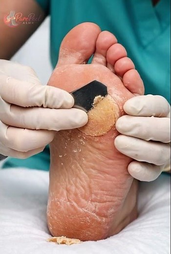 Relaxing Foot File Scraping ASMR | PurePeel ASMR #ASMRShorts #StressRelief