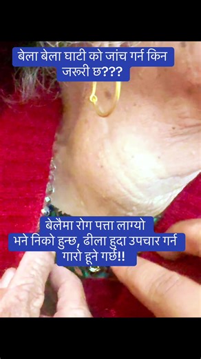 Understanding Neck Swelling Causes and Remedies