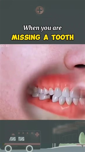 When you are missing a tooth #tooth #dental #Medical #viral #education | T.Medical.V