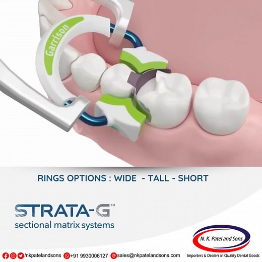 70K views · 158 reactions | Garrison's advanced materials and design...